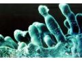 什么是真菌病害？什么是細(xì)菌病害？如果不懂后果很嚴(yán)重